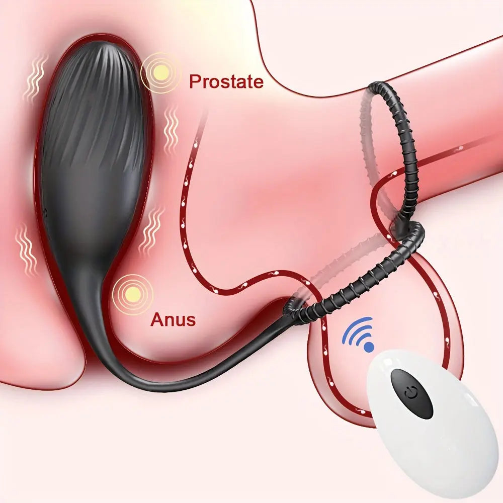 3-in-1 Prostate Massager With Double Penis Rings, 10 Vibration Modes Wireless Remote Control Anal Plug Sweetstoy