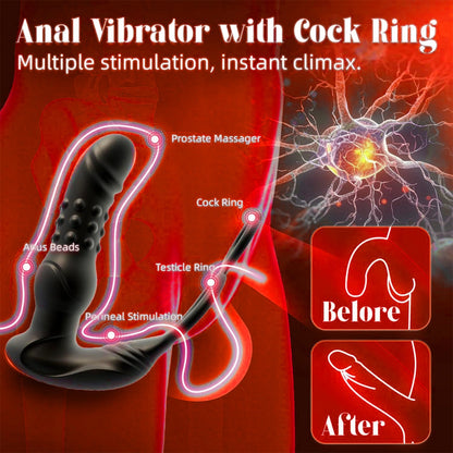 ST-PM-VF09 Thrusting Prostate Massager – APP Control, 9 Modes & Dual Ring