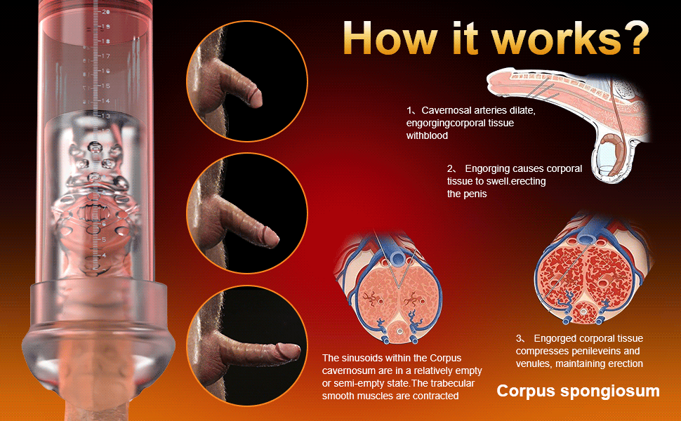 Vacuum chamber in detail.